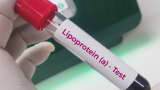 Blood sample for a lipoprotein(a) test.